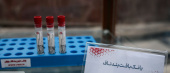 ذخیره‌سازی بیش از ۱۰۰ نمونه در بانک خون بند ناف جهاددانشگاهی استان مرکزی